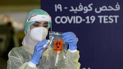 الصحة ​​تم تسجيل 2291 حالة إصابة جديدة بفيروس كورونا و 39 حالة وفاة