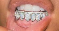 اخرهم كيم كاردشيان مشاهير وضعوا مجوهرات من الماس والذهب على اسنانهم
