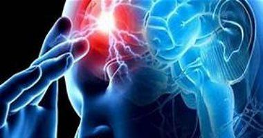 Do not ignore the continuous headache may expose you to the stranger of serious diseases