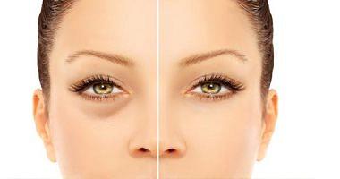 Signs appear on your face unveils the status of your body including pimples and eye bulges