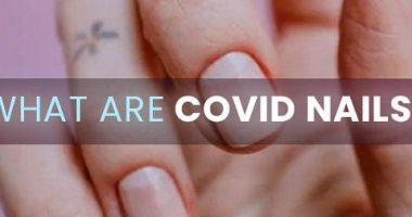 All you want to know about the causes and symptoms of Corona nails