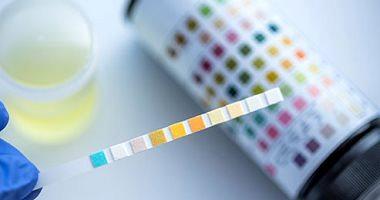 Facts you should know about urine analysis for diabetes