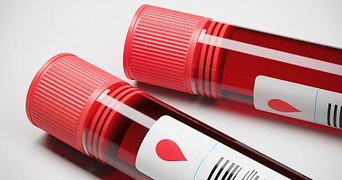 What is the blood albumin test
