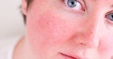 Tips to deal with skin sensitivity to avoid health problems