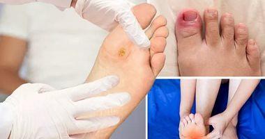 If you feel cooler in your feet you always have to have these diseases