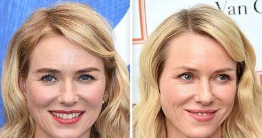 10 stars are free to make up on the red carpet Naomi Watts