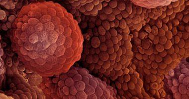 What is blood cancers and bone marrow