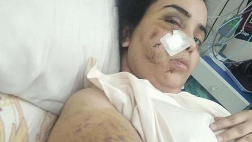 I jumped from the balcony Vibe accuses her husband tortured 3 hours a basin fractures