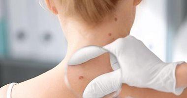 Study of potential targets for treating certain skin cancer