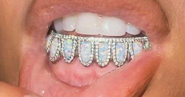 Other Kim Kardashian celebrities put jewelry from diamond and gold on their teeth