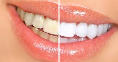 4 foods help to whiten tooth strawberry