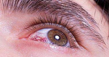 5 symptoms of a serious health problem in the eye Consult your doctor if you appear