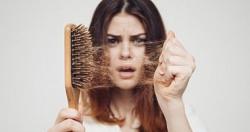 هل تعرف ما هي المكملات الغذائية التي يمكن أن تمنع تساقط الشعر؟