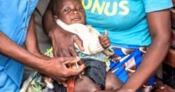 الصحه العالميه 800 الف طفل افريقى معرضين للخطر حصلوا على لقاح الملاريا