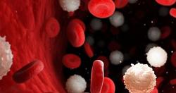 ما هي العوامل التي تزيد من خطر الإصابة بسرطان الدم عند الأطفال